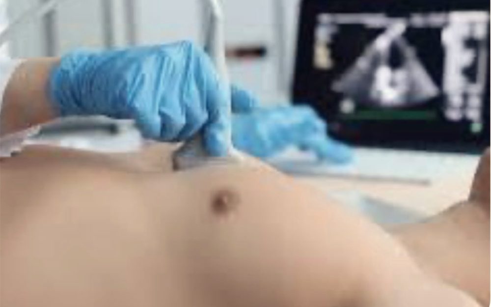 Ecocardiograma sendo realizado, com transdutor sobre o tórax e imagem do coração na tela